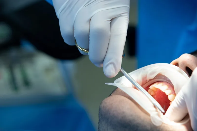 Root Canal Treatment in Delhi by Dr. Shweta Sehgal