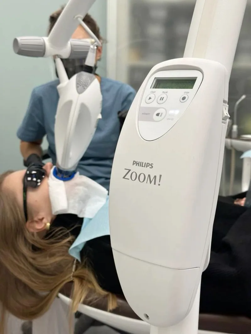 Zoom Teeth Whitening in Delhi – Best Dental Clinic